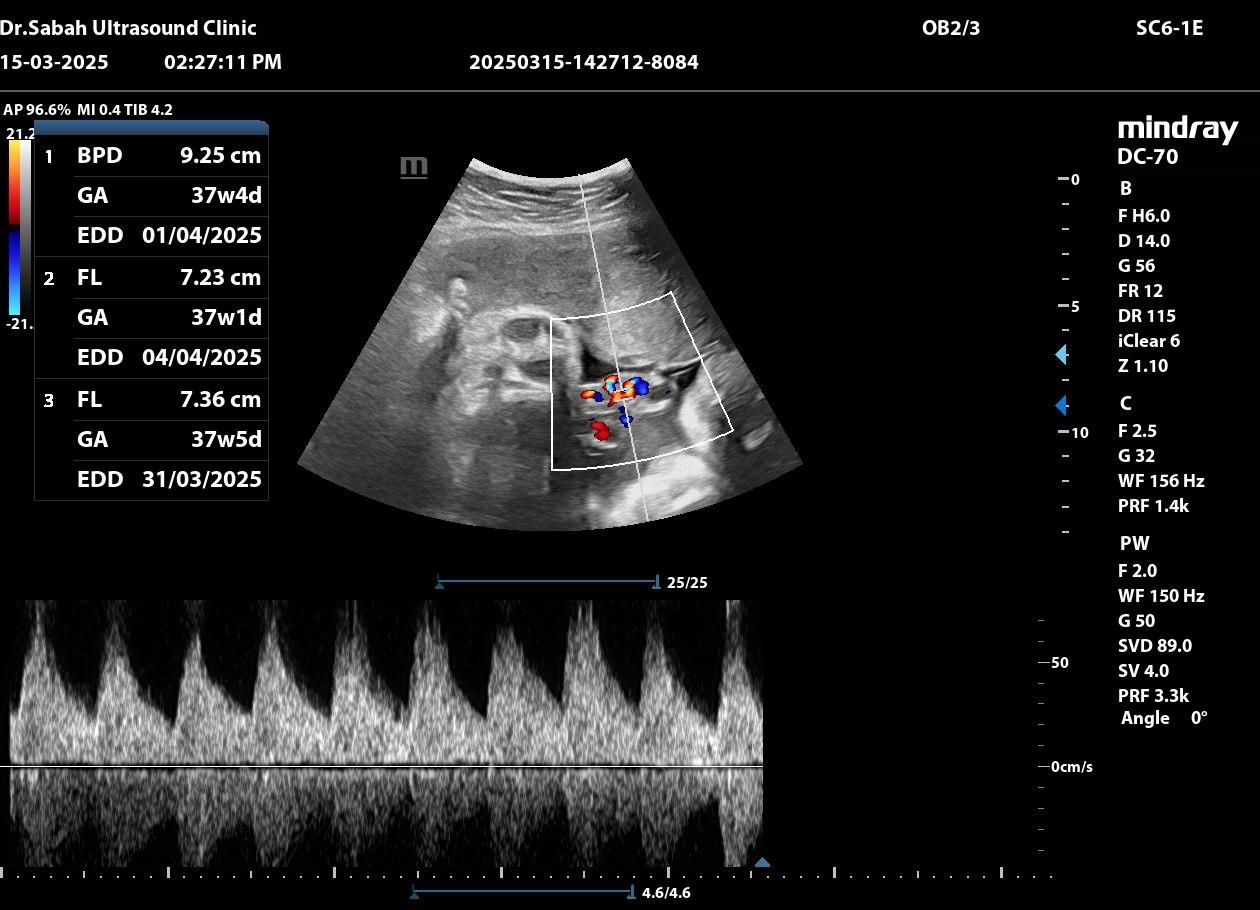 Ultrasound Machine