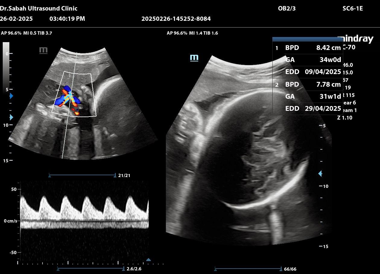 Ultrasound Machine
